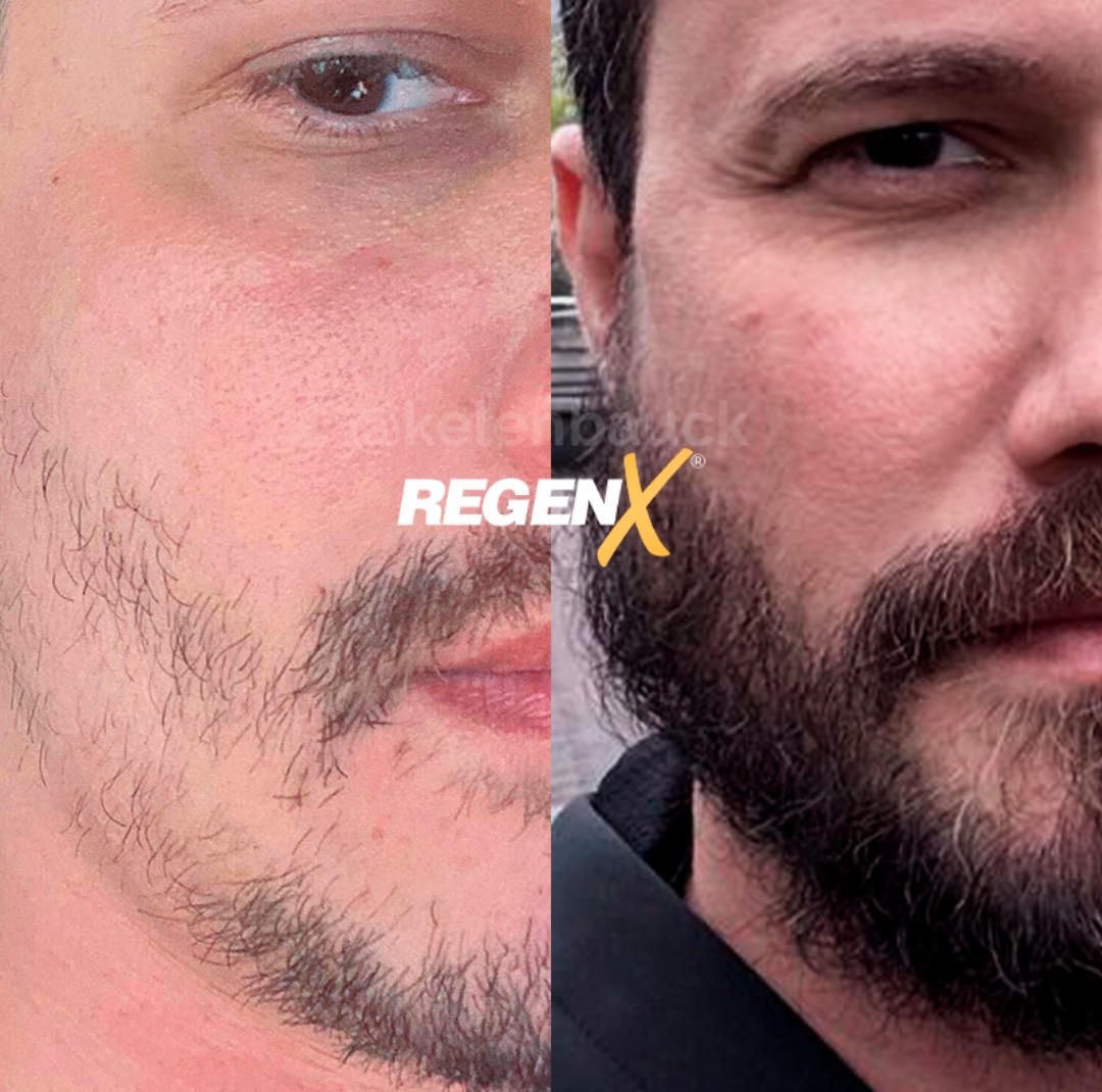 Regen X barbe