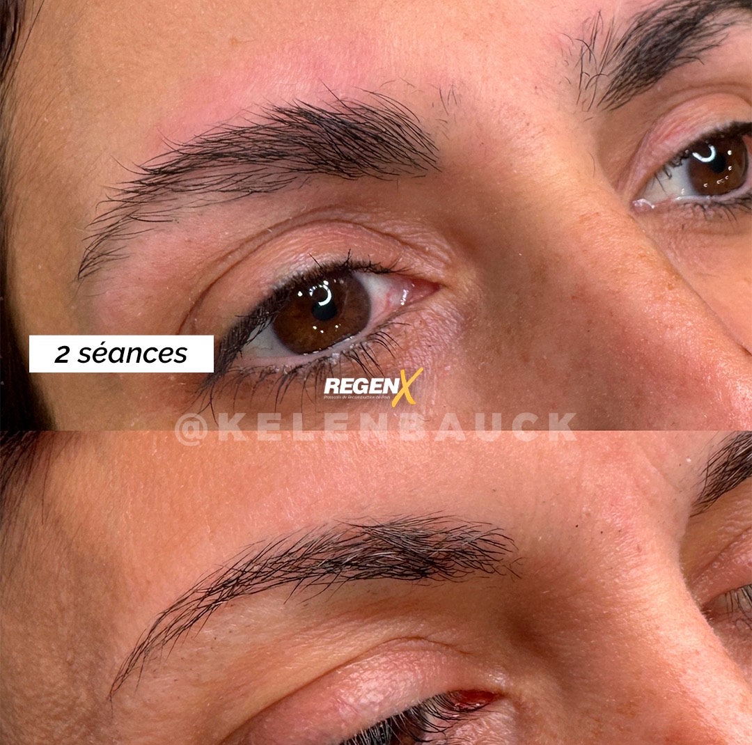 Regen X sourcils, 2 séances